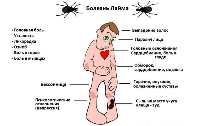 Лечение боррелиоза после укуса клеща схема